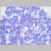 Pancreas SF 18.jpg